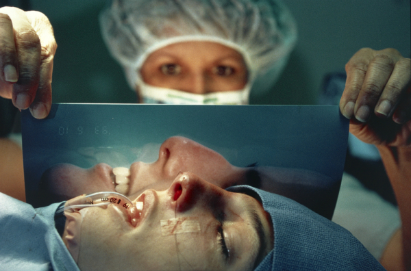 Ринопластика кончика носа