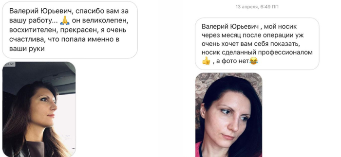 Ринопластика Валерий Стайсупов отзывы