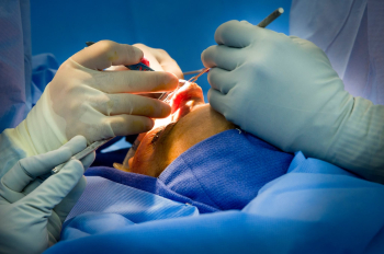 Ринопластика большого носа