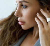 Пациентка доктора Валерия Стайсупова после закрытой ринопластики