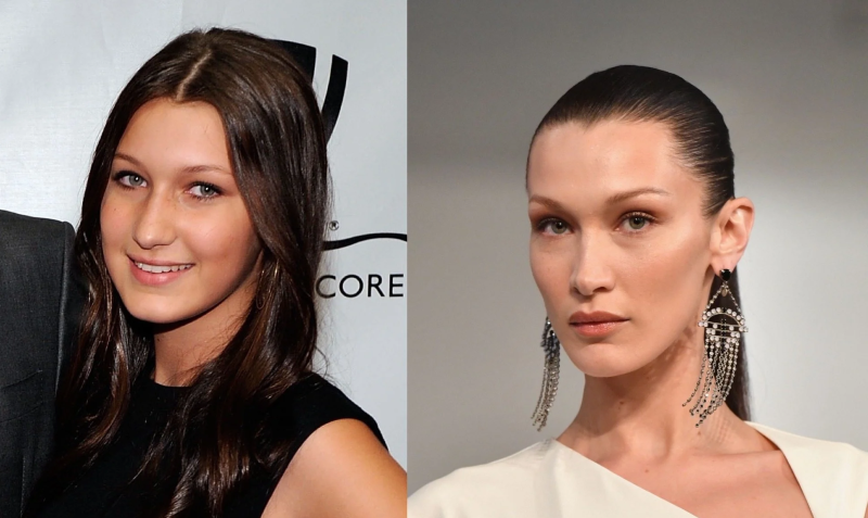 Супермодель Белла Хадид до и после ринопластики